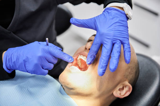 Best Emergency Gum Treatment in Hardin, MT